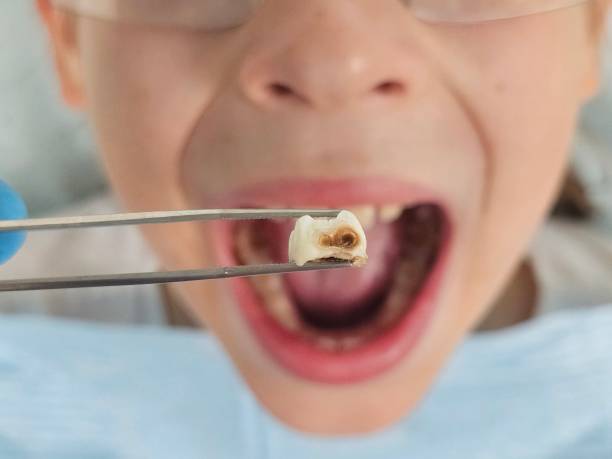 Best Emergency Dentist for Knocked-Out Tooth in Bloomingdale, TN