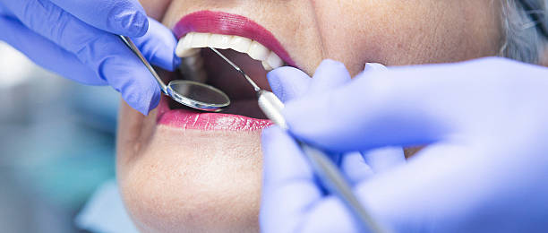 Best Emergency Dental Care for Abscessed Tooth in Bloomingdale, TN